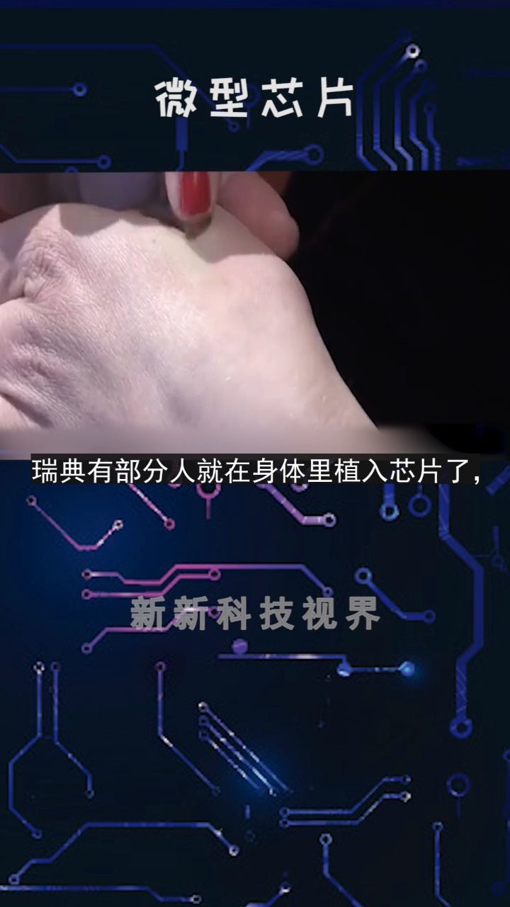 巷弄深处的科技与健康融合奇点，2017年人体芯片最新动态报道